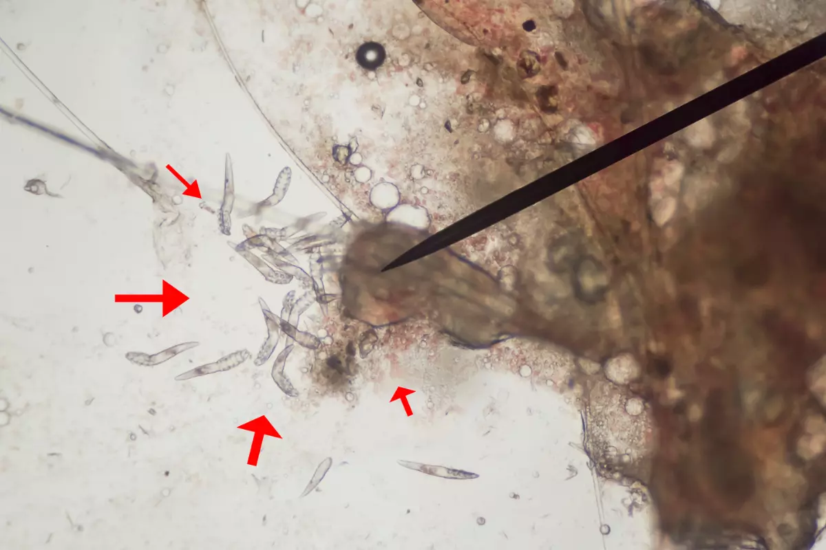 Nużyca u psa, demodex canis